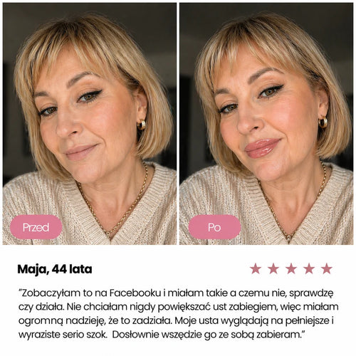 Powiększacz do ust Sofie